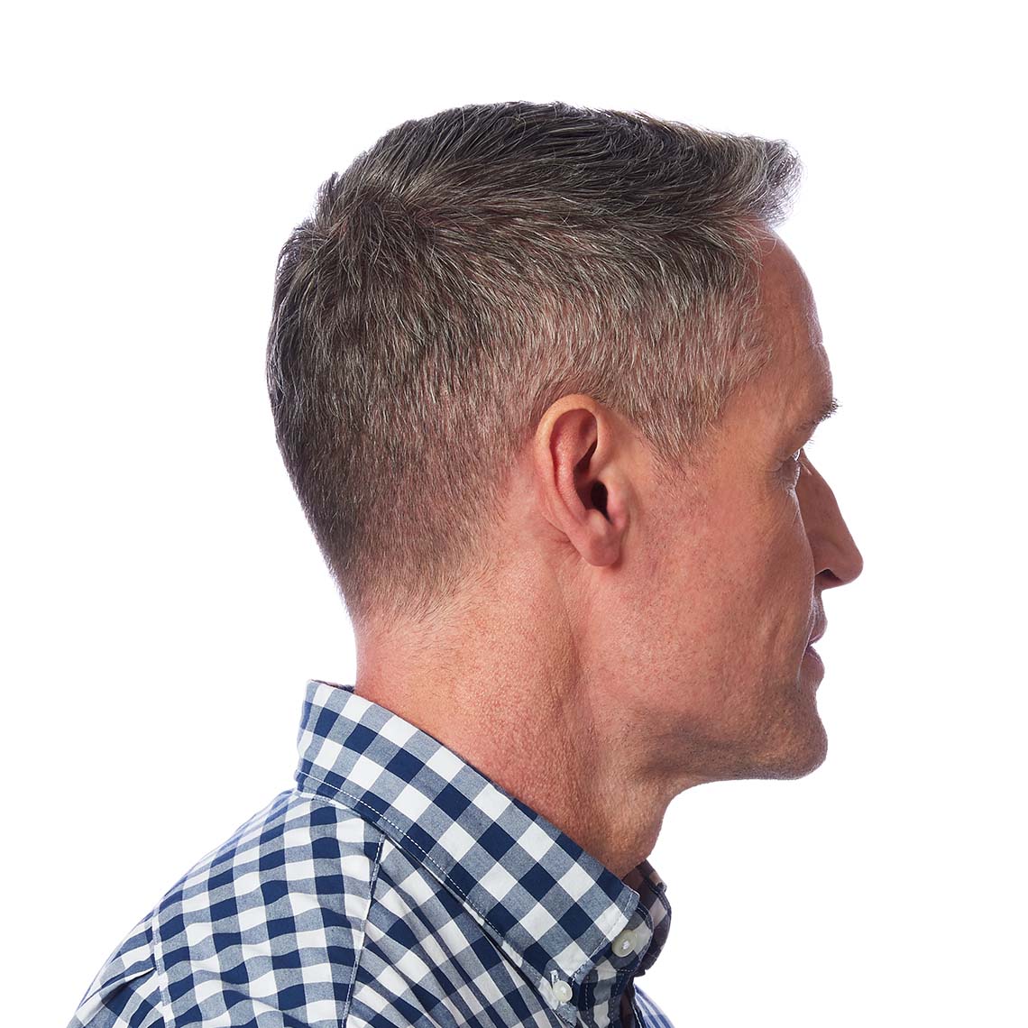 Completely in the canal (CIC) hearing aids, Hearing Aid Solutions